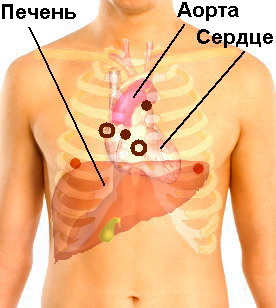 Как расположено сердце у человека фото и как болит